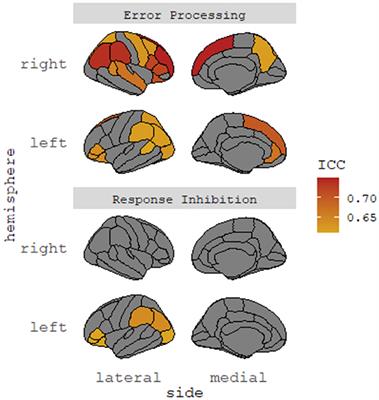 Characterizing the Neural Correlates of Response Inhibition and Error Processing in Children With Symptoms of Irritability and/or Attention-Deficit/Hyperactivity Disorder in the ABCD Study®